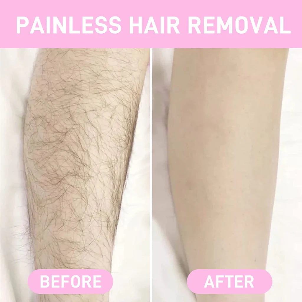 Crystal Hair Remover Removal Tool