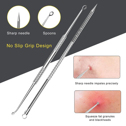 (1 Pc) Blackhead Remover Pin Needle Extractor Acne Pimple Cleaning Tool Black Head Removal Stainless Steel Stick - Whitehead Blackhead Remover Pin