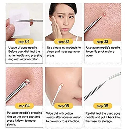 (1 Pc) Blackhead Remover Pin Needle Extractor Acne Pimple Cleaning Tool Black Head Removal Stainless Steel Stick - Whitehead Blackhead Remover Pin